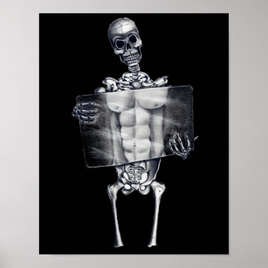 骨組胸部レントゲンポスター ポスター Zazzle Co Jp