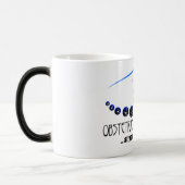 あなたの頚部のOB/GYN -おもしろいな医学 モーフィングマグカップ (左)