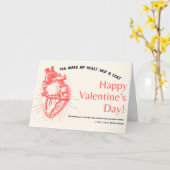 あなたは私のハートをスキップビート私のバレンタイン カード (黄色い花)