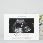 おばあちゃんの新しい超音波検査のお知らせ (スタンド正面)