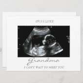 おばあちゃんの新しい超音波検査のお知らせ (正面/裏面)