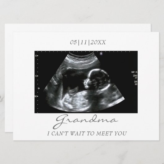 おばあちゃんの新しい超音波検査のお知らせ (正面/裏面)