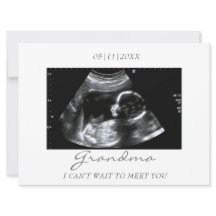 おばあちゃんの新しい超音波検査のお知らせ