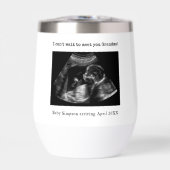 おばあちゃん妊娠告知の超音波写真 (正面)