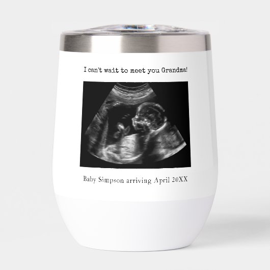 おばあちゃん妊娠告知の超音波写真 (正面)