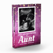 おばさん妊娠告知ベビーガール超音波検査 フォトブロック (左)