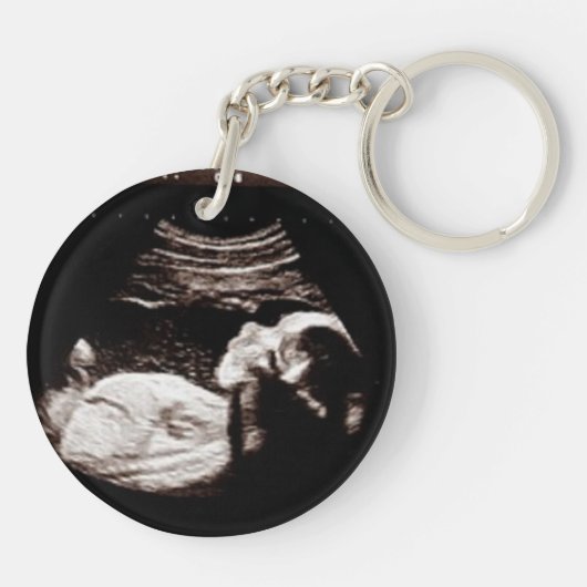 おばさん、妊娠の発表の超音波 キーホルダー (裏面)