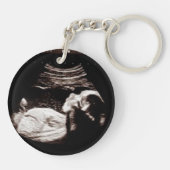 おばさん、妊娠の発表の超音波 キーホルダー (裏面)