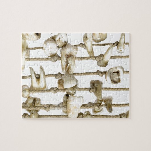 おもしろいな歯科写真撮影によって得られる歯の歯科医 ジグソーパズル (横)