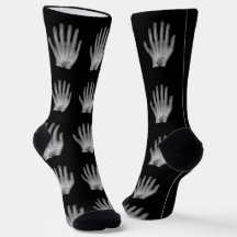 おもしろいポリダクティルハンドレントゲン写真