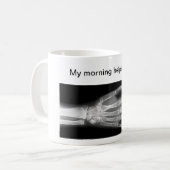 "おもしろい手"を救済する私の朝 コーヒーマグカップ (正面左)