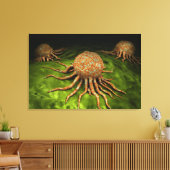 がんウイルスの顕微鏡的見解 キャンバスプリント (インサイチュ (リビング))