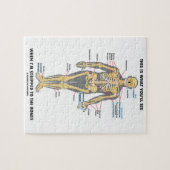 これは私が骨にいつ除去されるか見るものです ジグソーパズル (横)