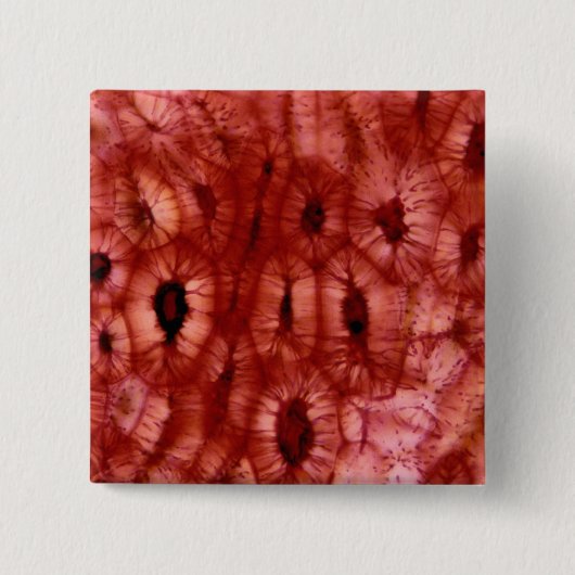 さくらんぼピットからのSclerenchymaの細胞 缶バッジ (正面)