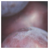 さくらんぼ梅 ファブリック (クローズアップ)