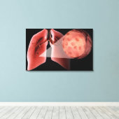 ぜんそく発作の間の気道の炎症 キャンバスプリント (インサイチュ (ウッドフロア))