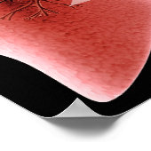 ぜんそく発作の間の気道の炎症 ポスター (角)