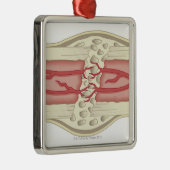 それ自身を修理する骨2 メタルオーナメント (右)