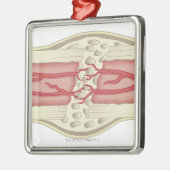 それ自身を修理する骨2 メタルオーナメント (左)