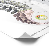 ~における脊髄亜脱臼の効フランスの果 ポスター (角)