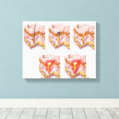 にきびの違う種類 キャンバスプリント (インサイチュ (ウッドフロア))