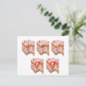 にきびの違う種類 ポストカード (スタンド正面)