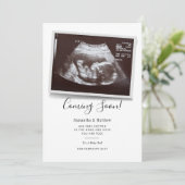 の来すぐにスクリプト超音波ソノグラム妊娠 案内状 (スタンド正面)