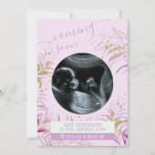 の来近日超音波写真ピンクの金ゴールドの葉 案内状 (正面)