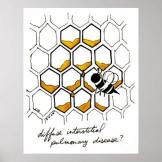 びまん性間質性肺疾患 ポスター