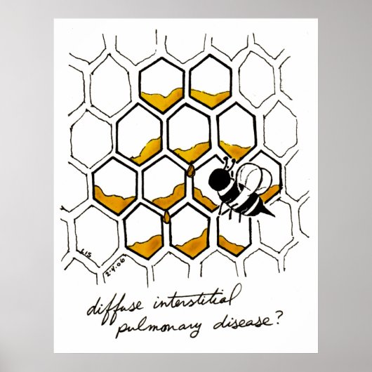 びまん性間質性肺疾患 ポスター (正面)