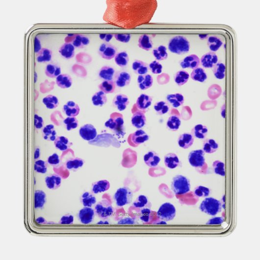 ぶどう球菌の伝染 メタルオーナメント (正面)