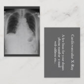 ぽっちゃりした箱X光線の~ 名刺 (正面/裏面)