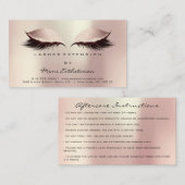 アフターケアの指示の点滅赤面バラ金ゴールド 名刺 (正面/裏面)