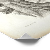 アンティーク頸肩筋医療プリント ポスター (角)