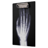 インタおもしろいーネット中毒者用ハンドX線 クリップボード (左)