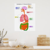 インフルエンザ感染図の主な症状 ポスター (キッチン)