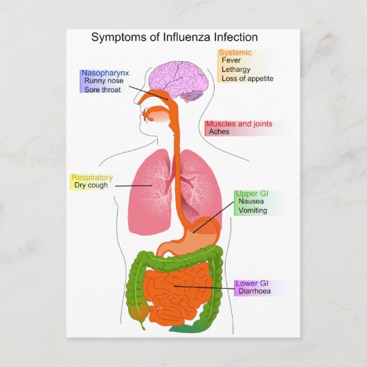 インフルエンザ感染図の主な症状 ポストカード (正面)