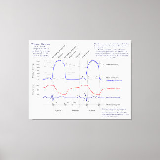 ウィガーズ図 キャンバスプリント