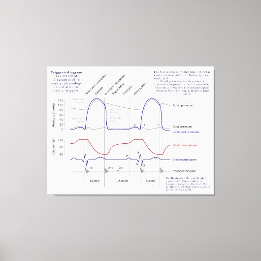 ウィガーズ図 キャンバスプリント (正面)