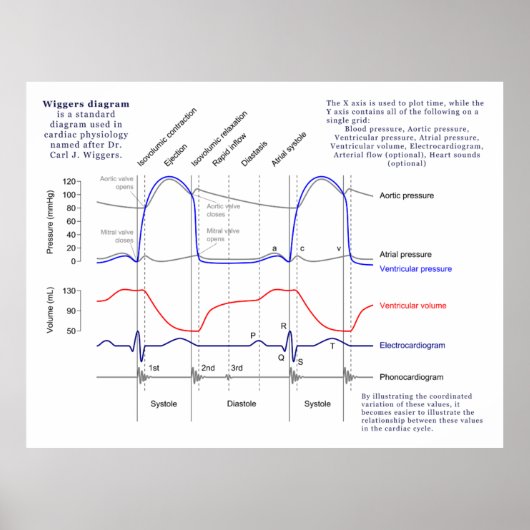 ウィガーズ図 ポスター (正面)