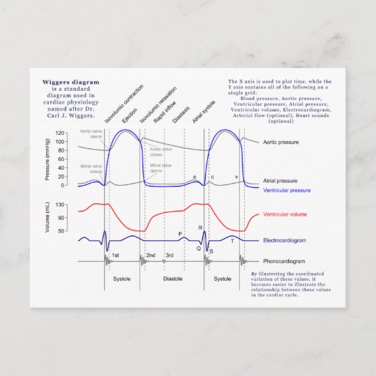 ウィガーズ図 ポストカード (正面)