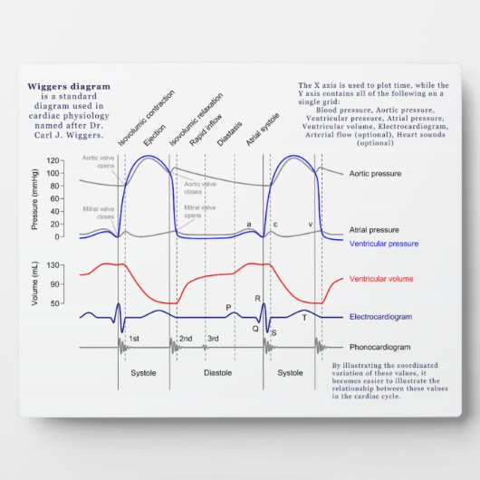 ウィッガーズ図 フォトプラーク (正面)