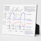 ウィッガーズ図 フォトプラーク (側面)