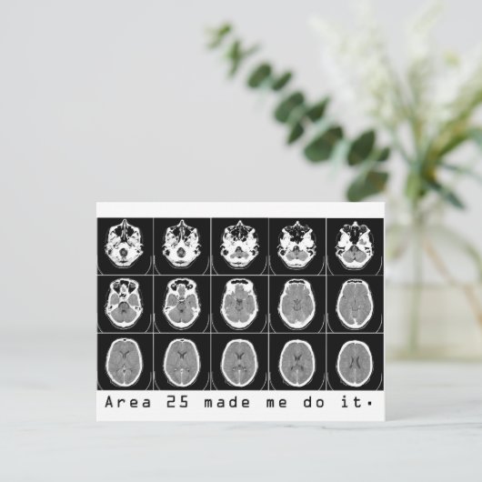 エリア25は私にそれを行わせた。 ポストカード (スタンド正面)