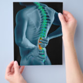 カイロプラクタービジネスフライヤー チラシ (手)