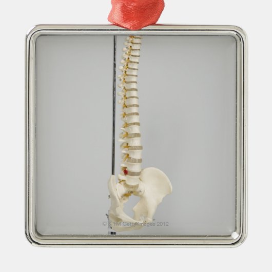 カイロプラクティックの骨組 メタルオーナメント (正面)
