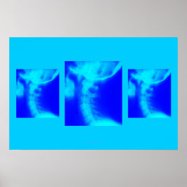 カイロプラクティックポスター：外側子宮頸部ブルース ポスター