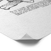 カイロプラクティック亜脱臼ヴィンテージプリント ポスター (角)