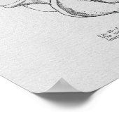 カイロプラクティック椎骨亜脱臼ヴィンテージプリント ポスター (角)