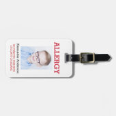 カスタムな写真はアレルギーの注意深い氷の警告のバッジをからかいます ラゲッジタグ (正面横)